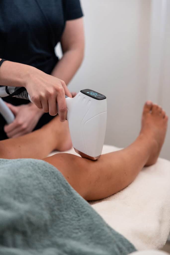Laserontharing bij Merebelle